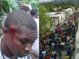 Haiti - Petit-Goâve : 35th demonstration, violence, injuries and vandalism...