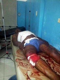 iciHaïti - FLASH : Le candidat à la mairie de Marigot abattu par balles