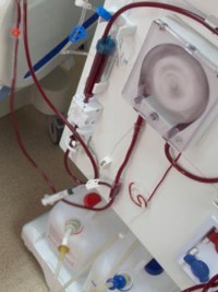 iciHaiti - Health : Dialysis, the lives of patients, at risk to HUEH