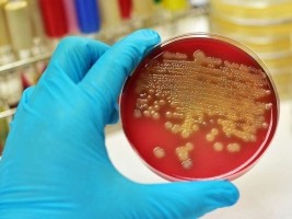 Haïti - Santé : La diphtérie tue en Haïti...