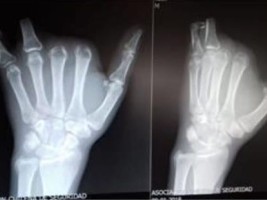 Haïti - Chili : Un haïtien poursuit son employeur pour 271 millions de pesos