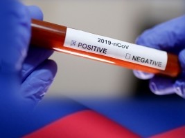 iciHaïti - Covid-19 : Un technicien de la Direction d’Épidémiologie de Laboratoires et de Recherches testé positif