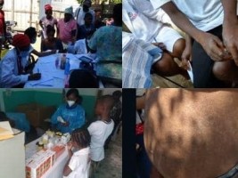 Haiti - Health : The Government mobilized against a very contagious skin infection...