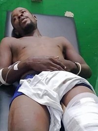 iciHaïti - Port-de-Paix : Le Chef de gang «Général» blessé et arrêté 