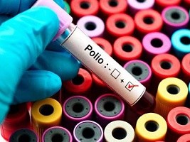 iciHaïti - Santé : Haïti, pays à très haut risque de poliomyélite