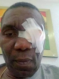 Haïti - FLASH : Le Président du Sénat, blessé dans une attaque d'individus armés 