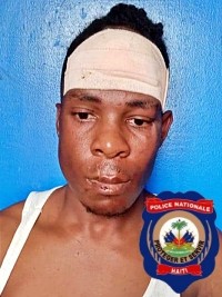 iciHaïti - Cap-Haïtien : Un braqueur arrêté, son complice lynché