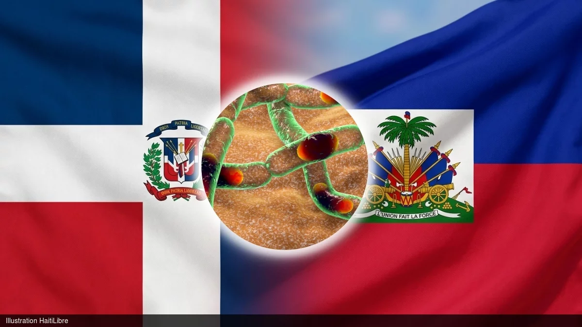 iciHaïti - Anthrax : La République Dominicaine renforce la surveillance sanitaire à la frontière