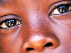 Haiti - Health : Free Eye Surgical operations, Cubans in the Southwest