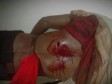 Haiti - FLASH : Demonstration repressed by the CIMO, 1 dead and 2 wounded by bullets