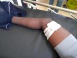iciHaïti - Petit-Goâve : Manifestation et violence, un élève blessé par balle