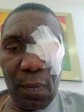 Haiti - FLASH : The President of the Senate, injured in an attack by armed individuals
