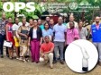 Haïti - Technologie Santé : Introduction de la thermoablation en Haïti