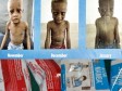 iciHaïti - Santé : «Meds and Food for Kids» lutte contre la malnutrition en Haïti (vidéo)