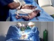 iciHaïti - Caravane chirurgicale : Une adolescente de 16 ans donne naissance a des jumeaux